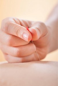 Acupunctuur is vanwege de zeer dunne naalden pijnloos